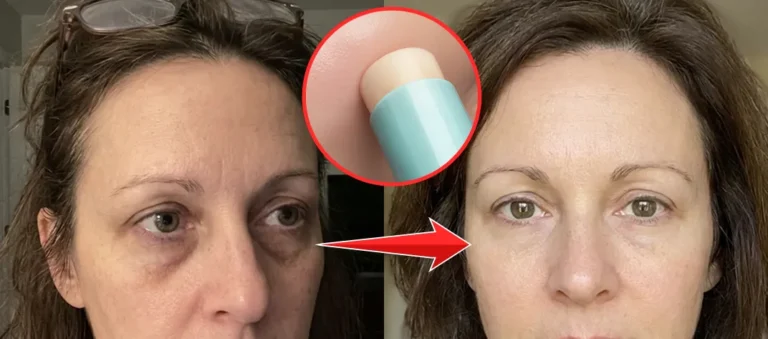 Best Eye Cream for Dark Circles (2026): 7 Picks Ranked & Reviewed