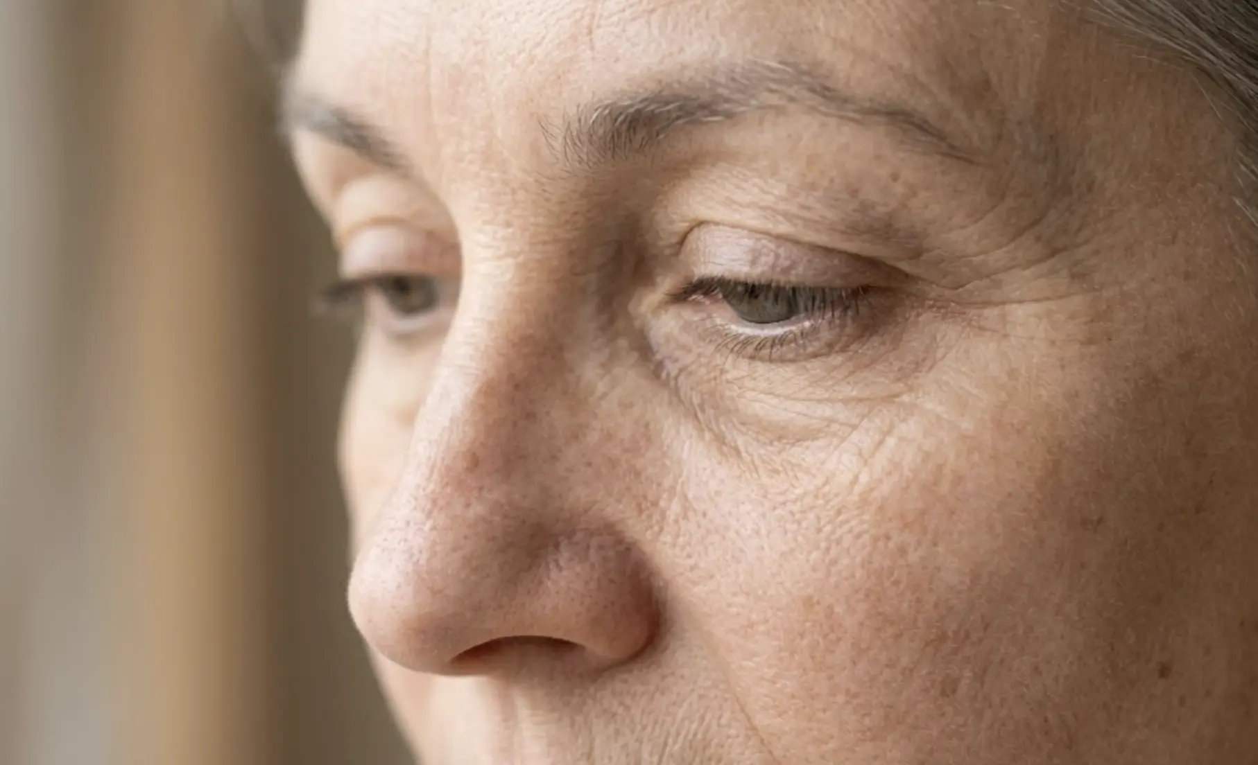 Close-up of mature woman's under-eye area showing tear trough hollowing